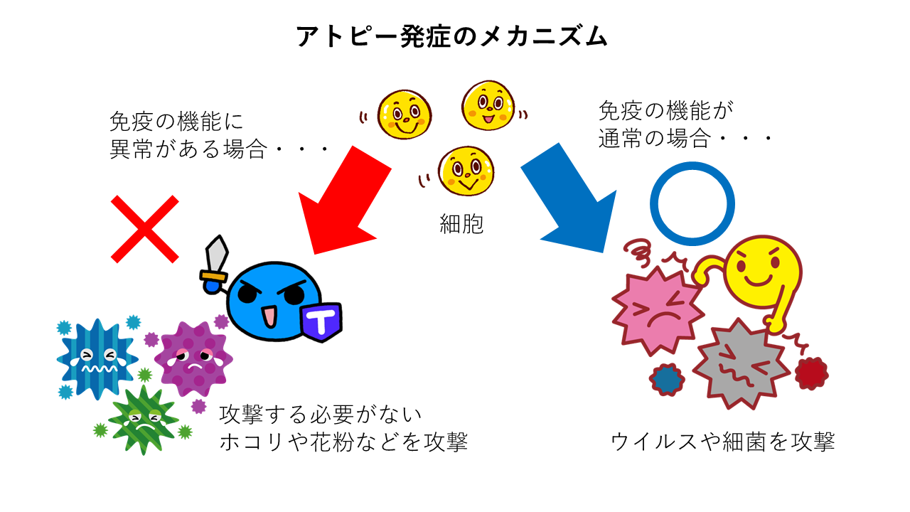 アトピー発症のメカニズム